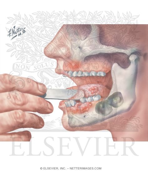 Watermarked preview of unlabeled image: Pathology of Mouth and Jaws