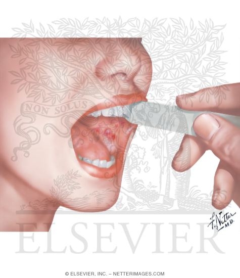Watermarked preview of unlabeled image: Mucous Membranes of Oral Cavity