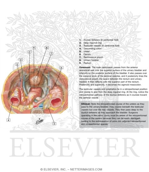 Watermarked preview of labeled image: Pelvic Contents: Male