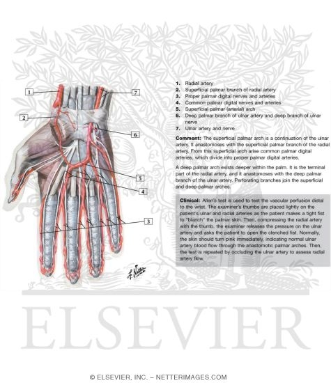 Watermarked preview of labeled image: Blood and Lymph Vessels
Arteries and Nerves of Hand: Palmar Views