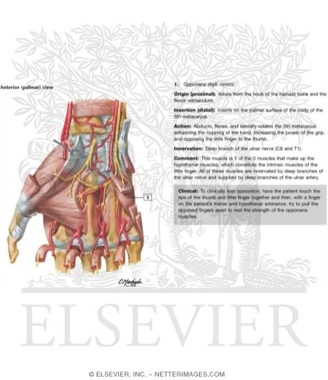Watermarked preview of labeled image: Intrinsic Muscles of Hand