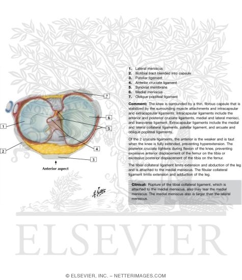 Watermarked preview of labeled image: Interior Superior View of Tibia
Axial View of Meniscus