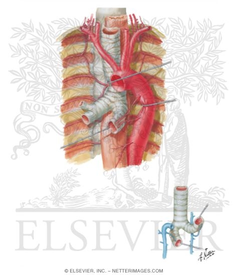 Bronchial Arteries and Veins