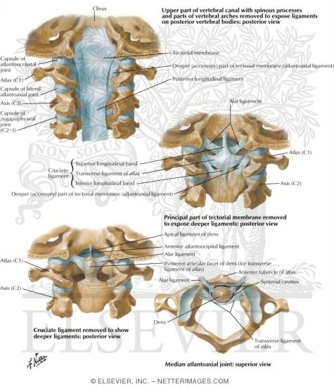 Watermarked preview of labeled image: Internal Craniocervical Ligaments