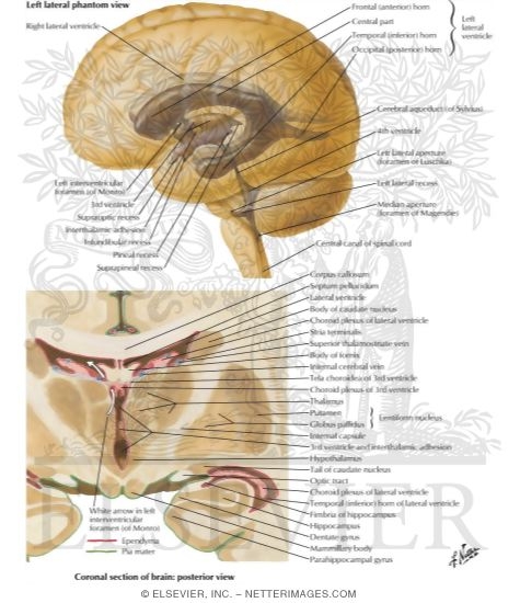 Watermarked preview of labeled image: Ventricles of Brain