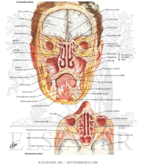 Watermarked preview of labeled image: Paranasal SinusesNasal Allergy