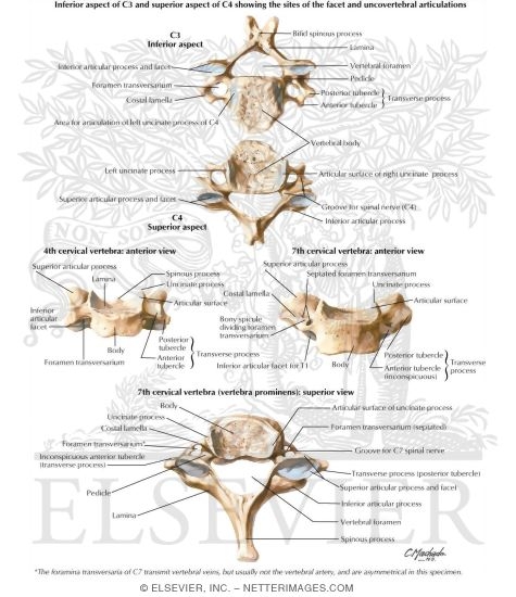 cervical vertebrae labeled axis