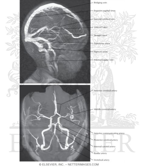 Cranial Imaging (MRV and MRA)