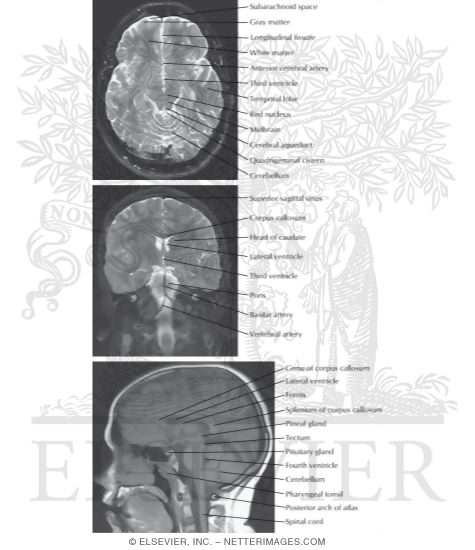 Watermarked preview of labeled image: Cranial Imaging (MRI)