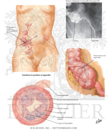 (Vermiform) Appendix
Appendix Vermiformis