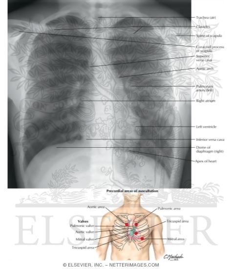 Radiograph of Chest