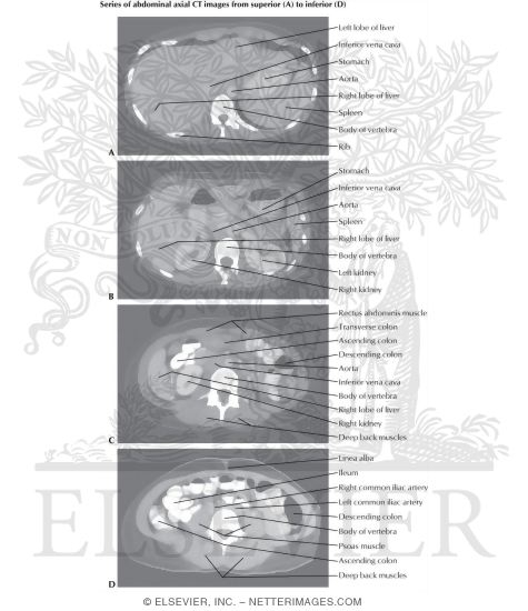 Abdominal Scans: Axial CT Images