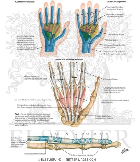 Watermarked preview of labeled image: Lumbrical Muscles and Bursae, Spaces and Sheaths: Schema