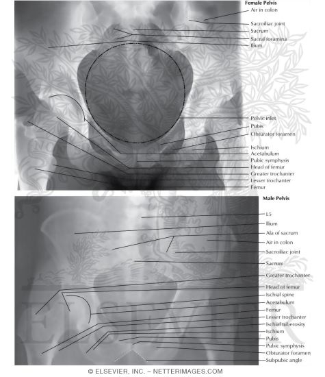 Watermarked preview of labeled image: Female and Male Pelvis Radiographs