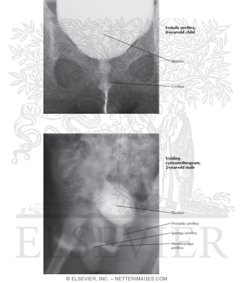 Watermarked preview of labeled image: Male and Female Cystourethrograms