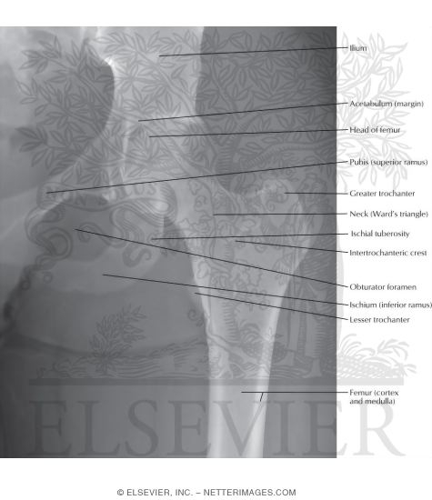 Hip Joint: Anteroposterior Radiograph