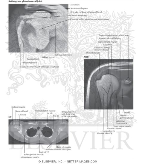 Shoulder Arthrogram, MRI and CT
