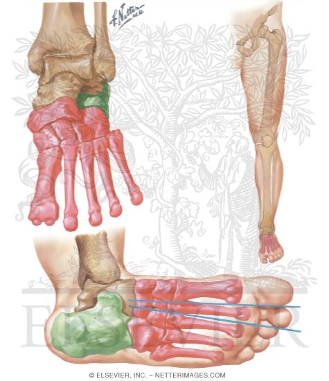 Watermarked preview of unlabeled image: Motion in Foot and Distribution of Weight