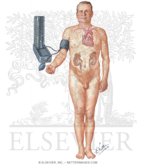 Watermarked preview of unlabeled image: Specific Causes of Hypertension to be Ruled Out