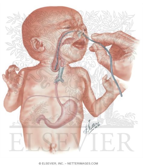 Watermarked preview of unlabeled image: Emergency Surgery of Newborn