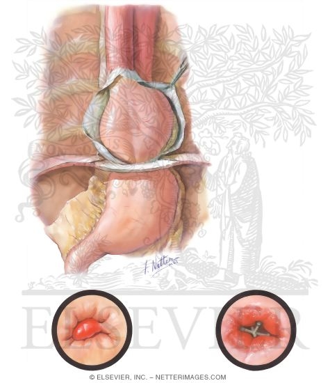 Watermarked preview of unlabeled image: Thoracic Stomach