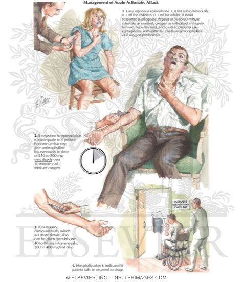 Watermarked preview of labeled image: Management of Acute Asthmatic Attack