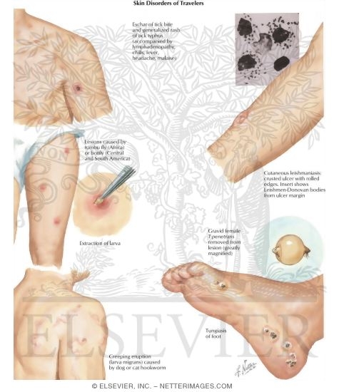 Watermarked preview of labeled image: Common Skin Disorders of Travelers