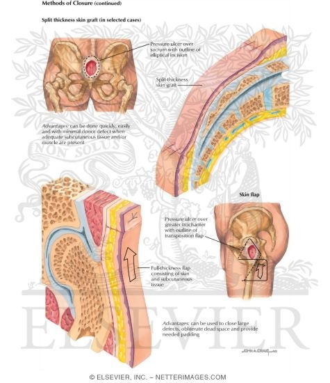 Watermarked preview of labeled image: Methods of Closure