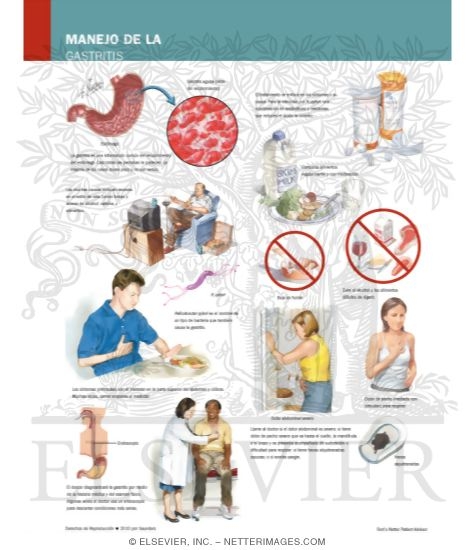 Watermarked preview of labeled image: Managing Your Gastritis
