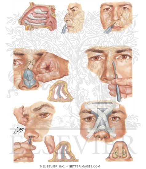 Watermarked preview of unlabeled image: Acute Fracture Dislocation