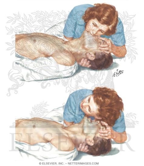 Watermarked preview of unlabeled image: Mouth-To-Mouth Ventilation