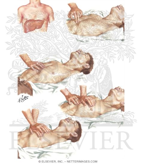 Watermarked preview of unlabeled image: Placement of Hands