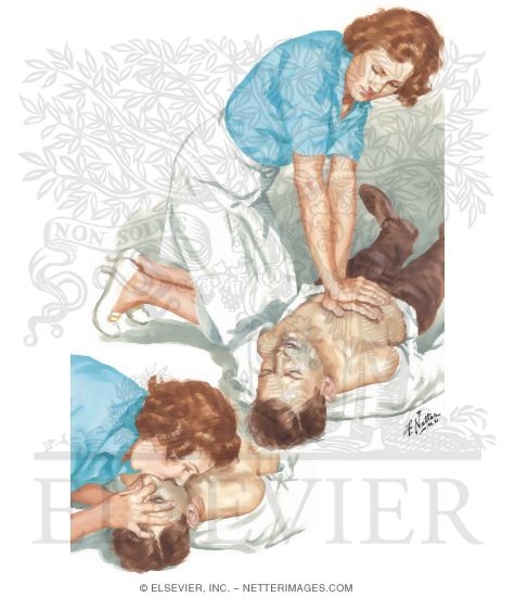 Watermarked preview of unlabeled image: One-Rescuer Resuscitation