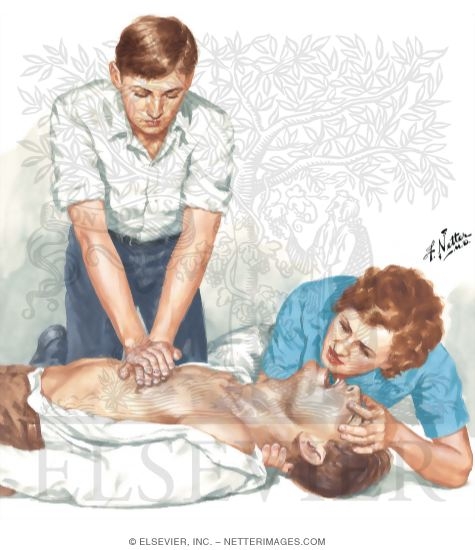 Watermarked preview of unlabeled image: Two-Rescuer Resuscitation