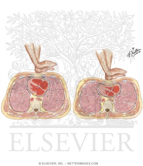 Watermarked preview of unlabeled image: Anatomy of Cardiac Compression