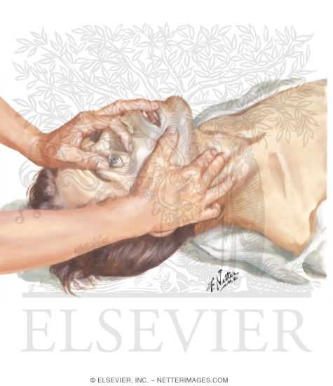 Watermarked preview of unlabeled image: Pupillary Constriction
