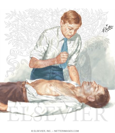 Watermarked preview of unlabeled image: Precordial Thump