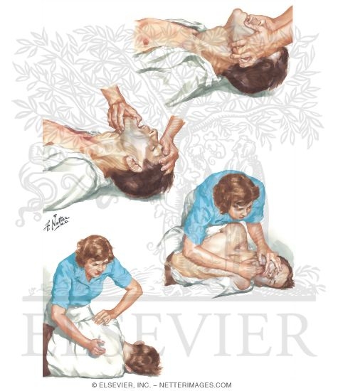 Watermarked preview of unlabeled image: Supplemental Methods for Airway