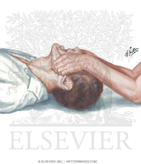 Watermarked preview of unlabeled image: Airway, Supplemental Method: Jaw Thrust