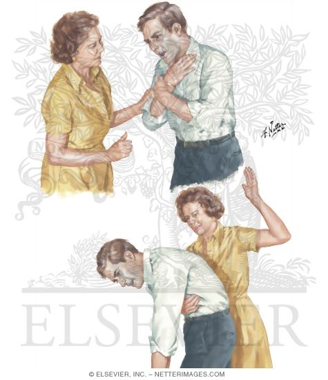 Watermarked preview of unlabeled image: Airway Obstruction in a Conscious Patient