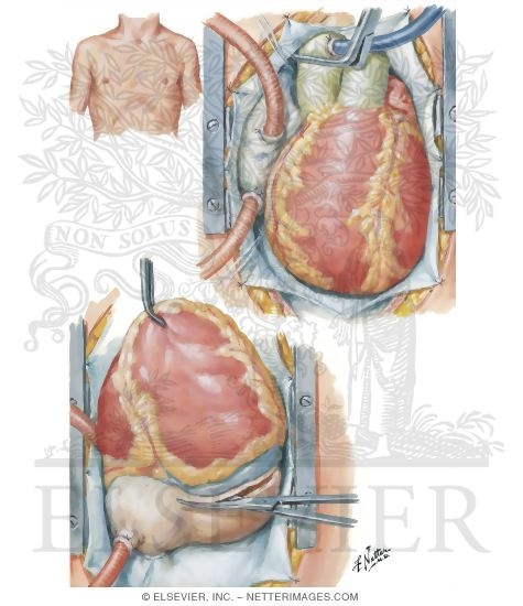 Watermarked preview of unlabeled image: Operative Procedure