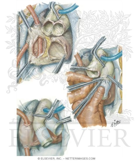 Watermarked preview of unlabeled image: Operative Procedure