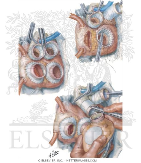 Watermarked preview of unlabeled image: Operative Procedure