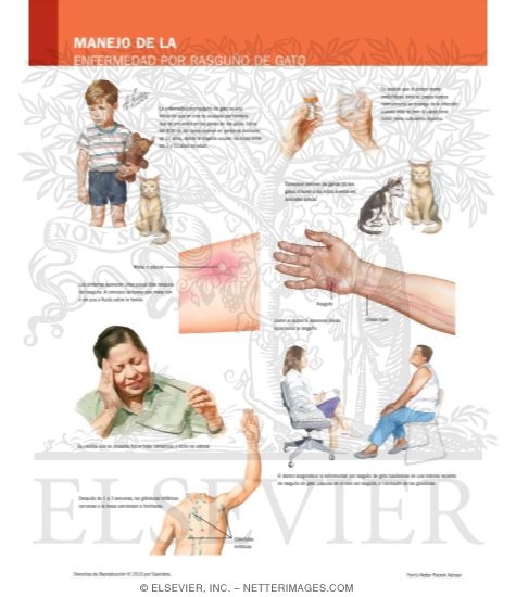 Managing Your Cat-Scratch Disease