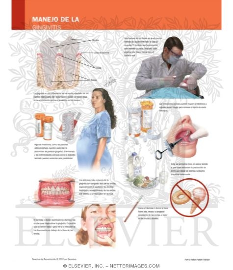 Watermarked preview of labeled image: Managing Your Gingivitis