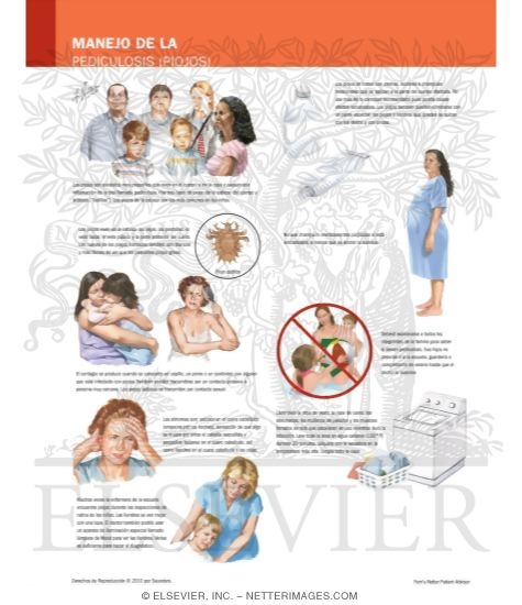 Watermarked preview of labeled image: Managing Your Lice