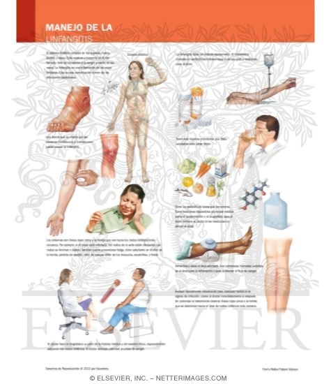 Managing Your Lymphangitis