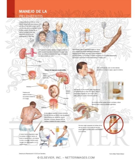 Watermarked preview of labeled image: Managing Your Pyelonephritis