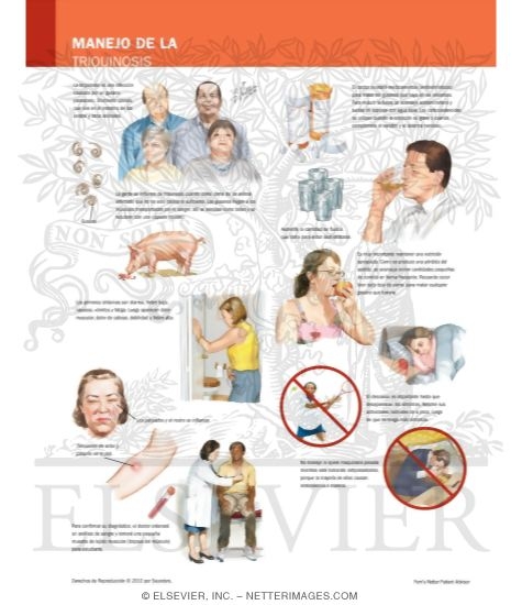 Managing Your Trichinosis