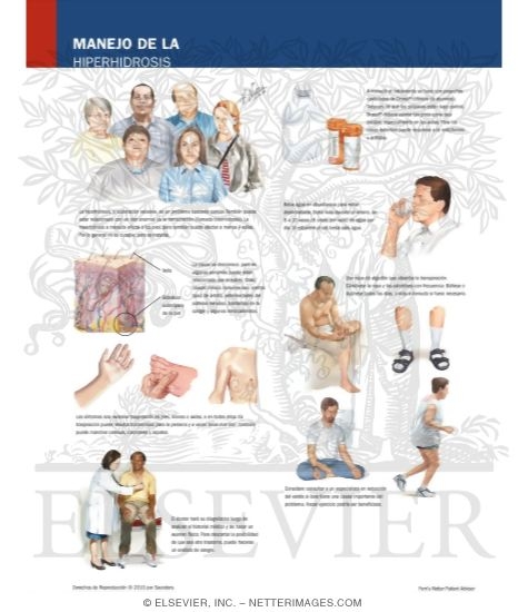 Watermarked preview of labeled image: Managing Your Hyperhydrosis